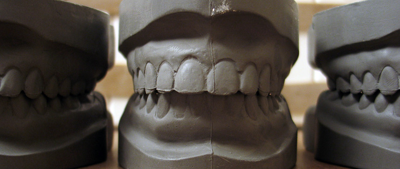 cast_teeth1.jpg